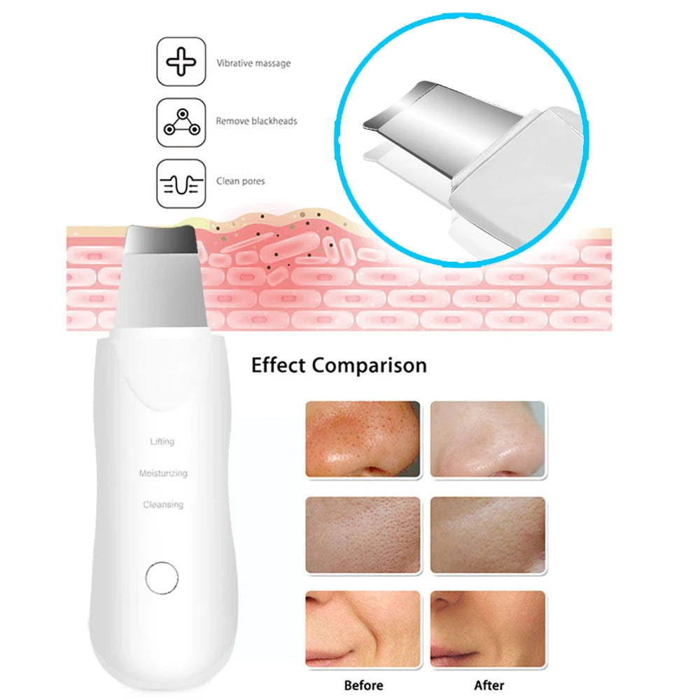 Vibration Facial Massage Skin Scrubber