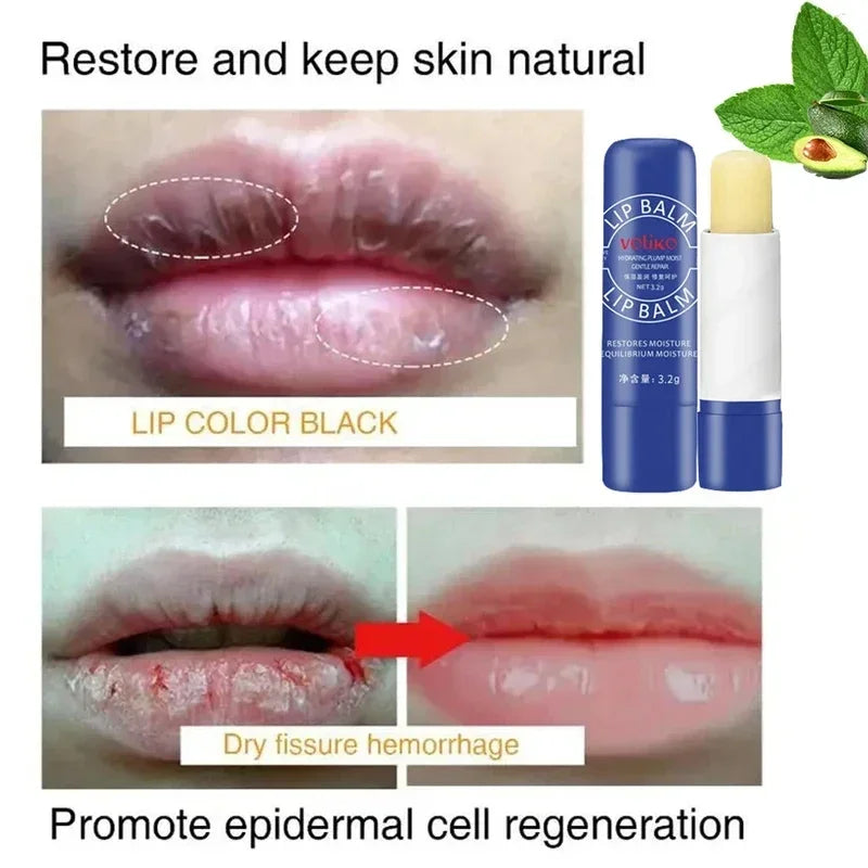 Lip Balm Remove Dark Lighten Melanin Lip Mask