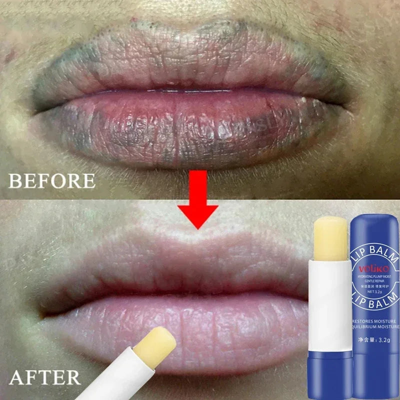 Lip Balm Remove Dark Lighten Melanin Lip Mask