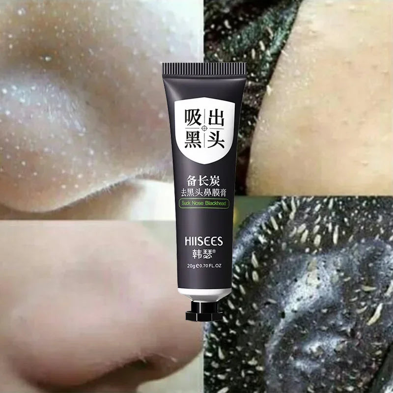 2-1PC Acne Deep Cleansing Blackhead Remover Face Mask Cream